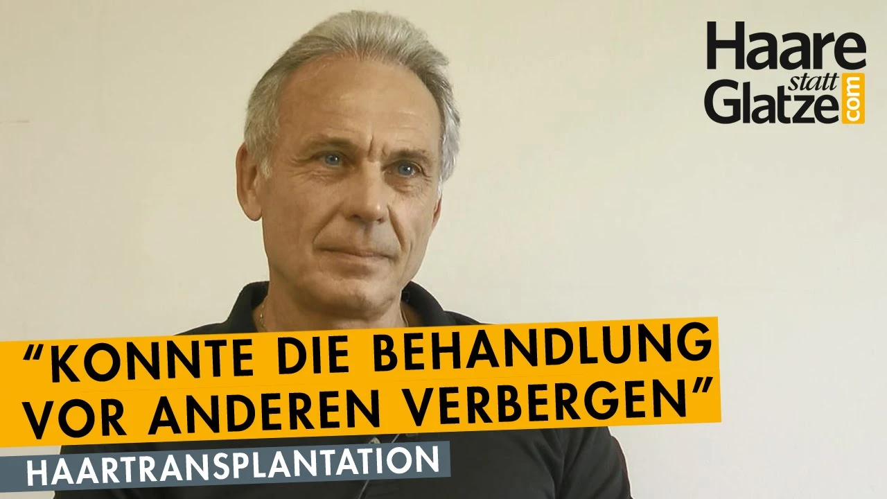 Angestellter 50+ stellt das Ergebnis seiner Haarverpflanzung vor
