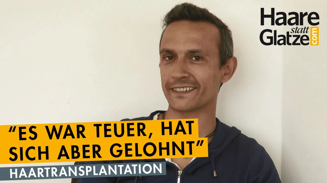 Beispiel für Haartransplantation bei den Geheimratsecken.