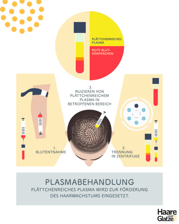 Haarausfall Therapie