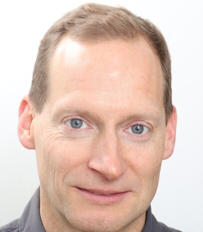 Vor der Haartransplantation
