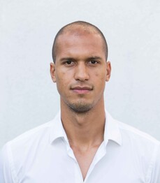 Fußballspieler Christian Schoissengeyr vor der Haartransplantation bei Moser Medical